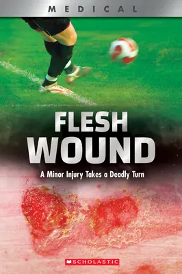 Tělesná zranění (Xbooks): Drobné zranění má smrtelný průběh - Flesh Wound (Xbooks): A Minor Injury Takes a Deadly Turn