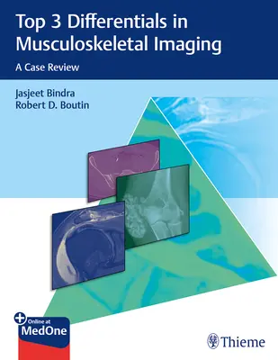 Top 3 diferenciály v zobrazování pohybového aparátu: Přehled případů - Top 3 Differentials in Musculoskeletal Imaging: A Case Review