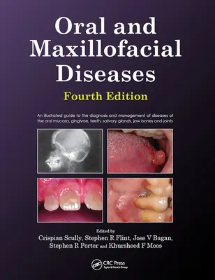 Onemocnění dutiny ústní a čelistní, čtvrté vydání - Oral and Maxillofacial Diseases, Fourth Edition