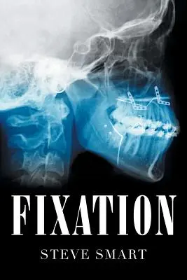 Fixace - Fixation