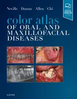 Barevný atlas ústních a čelistních chorob - Color Atlas of Oral and Maxillofacial Diseases