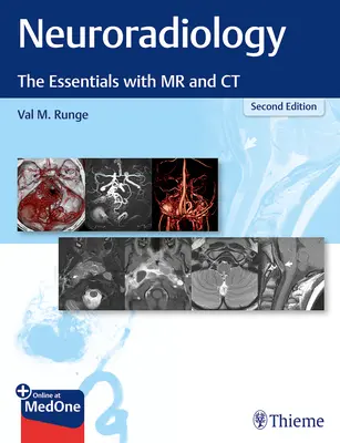 Neuroradiologie: Základní informace o MR a CT - Neuroradiology: The Essentials with MR and CT