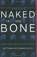 Nahá až na kost: lékařské zobrazování ve dvacátém století - Naked to the Bone: Medical Imaging in the Twentieth Century