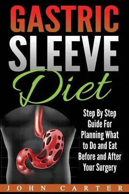 Dieta s žaludečním rukávem: Vychytávky: průvodce krok za krokem, jak plánovat, co dělat a jíst před operací a po ní - Gastric Sleeve Diet: Step By Step Guide For Planning What to Do and Eat Before and After Your Surgery