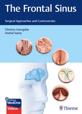 Frontální sinus: Surgical Approaches and Controversies (Chirurgické přístupy a kontroverze). - The Frontal Sinus: Surgical Approaches and Controversies