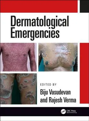 Dermatologické náhlé příhody - Dermatological Emergencies