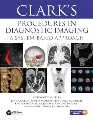 Clarkovy postupy v zobrazovací diagnostice - systémový přístup - Clark's Procedures in Diagnostic Imaging - A System-Based Approach