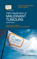 Tnm klasifikace zhoubných nádorů - Tnm Classification of Malignant Tumours