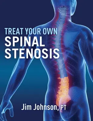 Léčba vlastní spinální stenózy - Treat Your Own Spinal Stenosis