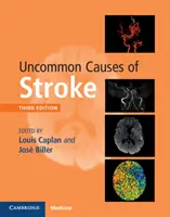 Neobvyklé příčiny mrtvice - Uncommon Causes of Stroke