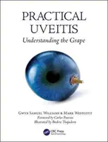 Praktický zánět očí: Pochopení hroznů - Practical Uveitis: Understanding the Grape