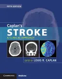 Caplanova mrtvice: A Clinical Approach (Klinický přístup) - Caplan's Stroke: A Clinical Approach