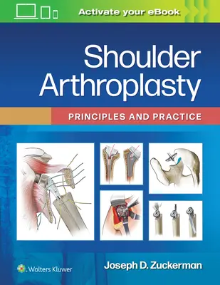 Artroplastika ramene: Principy a praxe - Shoulder Arthroplasty: Principles and Practice