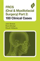 Frcs (Orální a maxilofaciální chirurgie) 2. část: 100 klinických případů - Frcs (Oral & Maxillofacial Surgery) Part 2: 100 Clinical Cases