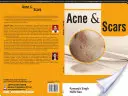 ACNE a SCARS - ACNE and SCARS