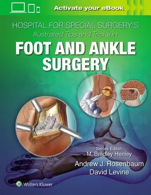 Hospital for Special Surgery's Illustrated Tips and Tricks in Foot and Ankle Surgery (Ilustrované tipy a triky v chirurgii nohy a kotníku) - Hospital for Special Surgery's Illustrated Tips and Tricks in Foot and Ankle Surgery