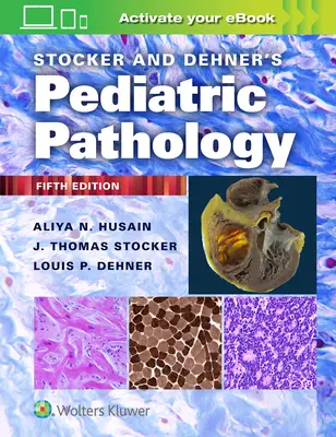 Stocker and Dehner's Pediatric Pathology (Stockerova a Dehnerova dětská patologie) - Stocker and Dehner's Pediatric Pathology