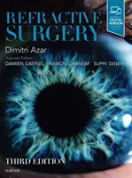 Refrakční chirurgie - Refractive Surgery