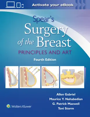 Spearova chirurgie prsu: Vydání knihy: Principy a umění - Spear's Surgery of the Breast: Principles and Art