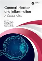 Infekce a záněty rohovky: Barevný atlas - Corneal Infection and Inflammation: A Colour Atlas