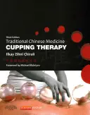 Baňková terapie tradiční čínské medicíny - Traditional Chinese Medicine Cupping Therapy