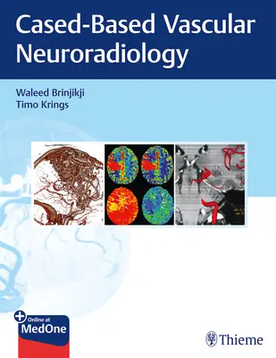 Zobrazovací metody u neurovaskulárních onemocnění: Přístup založený na konkrétních případech - Imaging in Neurovascular Disease: A Case-Based Approach