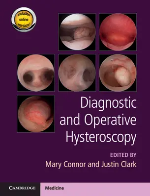 Diagnostická a operační hysteroskopie - Diagnostic and Operative Hysteroscopy