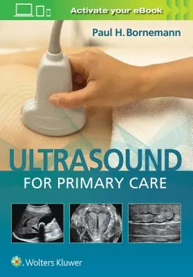 Ultrazvuk pro primární péči [s elektronickou knihou] - Ultrasound for Primary Care [With eBook]