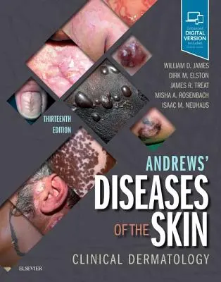 Andrewsovy kožní nemoci: Klinická dermatologie - Andrews' Diseases of the Skin: Clinical Dermatology