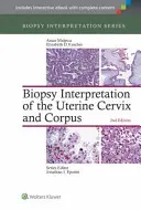 Interpretace biopsie děložního čípku a děložního těla - Biopsy Interpretation of the Uterine Cervix and Corpus