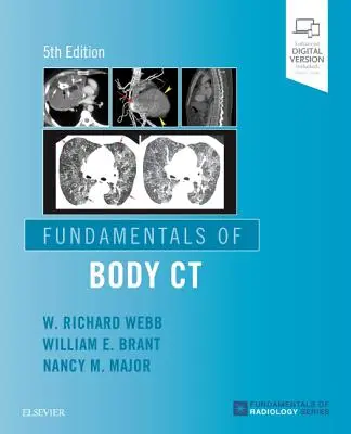 Základy tělesné CT - Fundamentals of Body CT