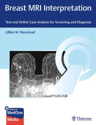 Interpretace magnetické rezonance prsu: Text a online analýza případů pro screening a diagnostiku - Breast MRI Interpretation: Text and Online Case Analysis for Screening and Diagnosis