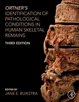 Ortnerova identifikace patologických stavů v lidských kosterních pozůstatcích - Ortner's Identification of Pathological Conditions in Human Skeletal Remains