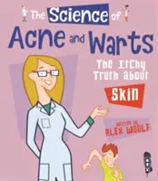 Věda o akné a bradavicích - svědivá pravda o kůži - Science Of Acne & Warts - The Itchy Truth About Skin