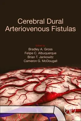 Cerebrální durální arteriovenózní píštěle - Cerebral Dural Arteriovenous Fistulas
