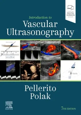 Úvod do cévní ultrasonografie - Introduction to Vascular Ultrasonography