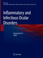 Zánětlivé a infekční oční poruchy - Inflammatory and Infectious Ocular Disorders