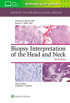 Interpretace biopsie hlavy a krku - Biopsy Interpretation of the Head and Neck