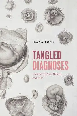 Spletité diagnózy: Prenatální testování, ženy a rizika - Tangled Diagnoses: Prenatal Testing, Women, and Risk