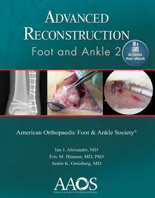 Pokročilá rekonstrukce: Noha a kotník 2: tištěná verze + elektronická kniha - Advanced Reconstruction: Foot and Ankle 2: Print + eBook