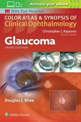 Glaukom - Glaucoma