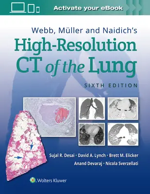 Webb, Mller a Naidich - CT plic s vysokým rozlišením - Webb, Mller and Naidich's High-Resolution CT of the Lung