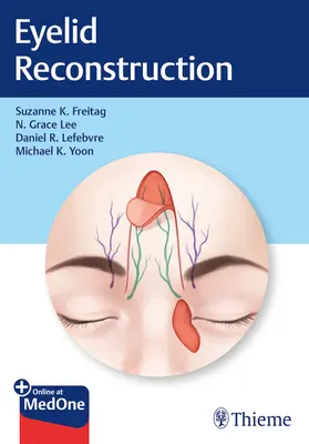 Rekonstrukce očních víček - Eyelid Reconstruction