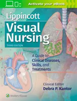 Vizuální ošetřovatelství Lippincott : A Guide to Clinical Diseases, Skills, and Treatments (Průvodce klinickými nemocemi, dovednostmi a léčbou) - Lippincott Visual Nursing: A Guide to Clinical Diseases, Skills, and Treatments
