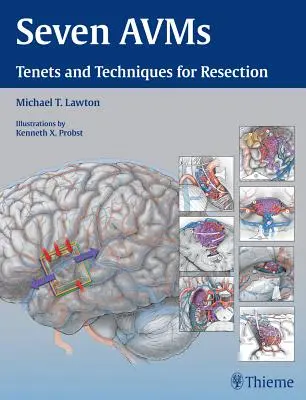 Sedm Avms: Desatero a techniky resekce - Seven Avms: Tenets and Techniques for Resection