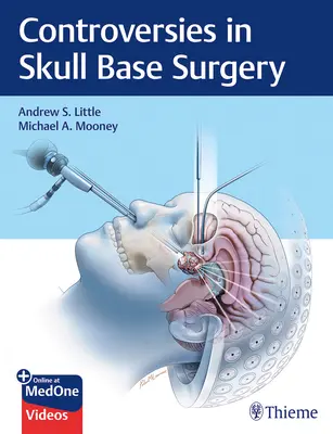 Kontroverze v chirurgii lebeční spodiny - Controversies in Skull Base Surgery