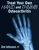 Léčba osteoartrózy rukou a palců - Treat Your Own Hand and Thumb Osteoarthritis