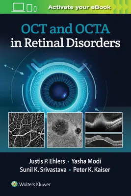 Oct a Octa u poruch sítnice - Oct and Octa in Retinal Disorders