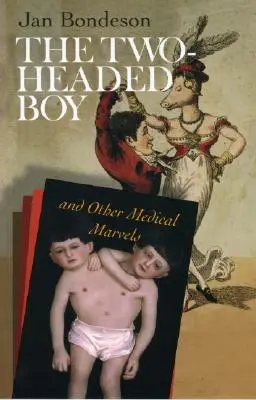 Dvouhlavý chlapec a jiné lékařské zázraky - The Two-Headed Boy, and Other Medical Marvels