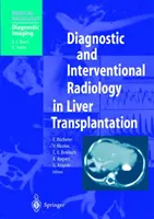 Diagnostická a intervenční radiologie při transplantaci jater - Diagnostic and Interventional Radiology in Liver Transplantation